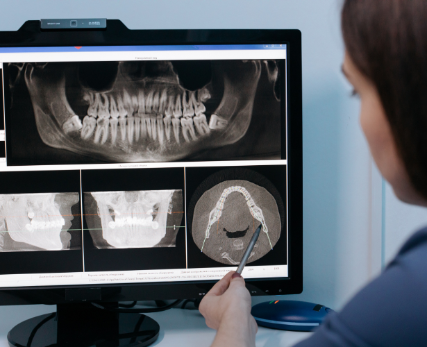 Dental Implant Process
