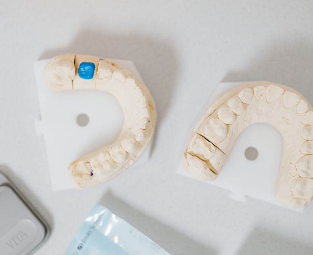Dental Implant Services