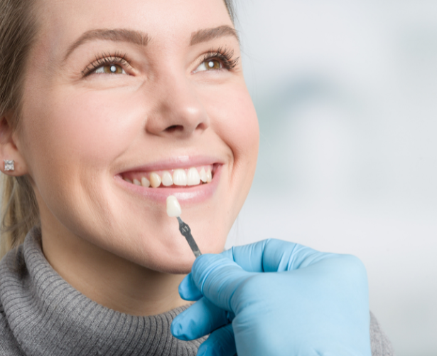 Smiling woman having a single veneer shade matched to her tooth
